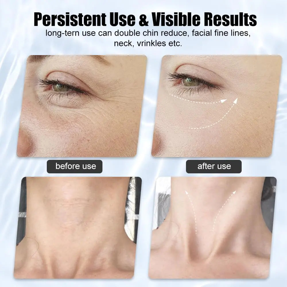 Firming Wrinkle Beauty Devicer for anti-aging and wrinkle reduction